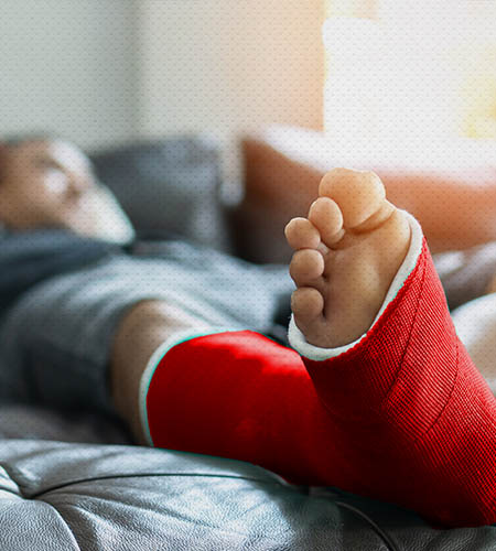 "An injured man with red cast on his foot"